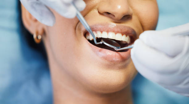 Best Emergency Dental Care for Broken or Chipped Teeth in Vernal, UT